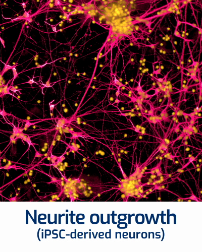 Neurite outgrowth